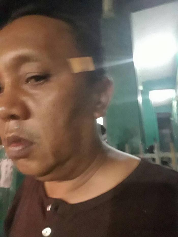 Ketua PWI Dumai Terkena Lemparan Batu Kelompok Tawuran
