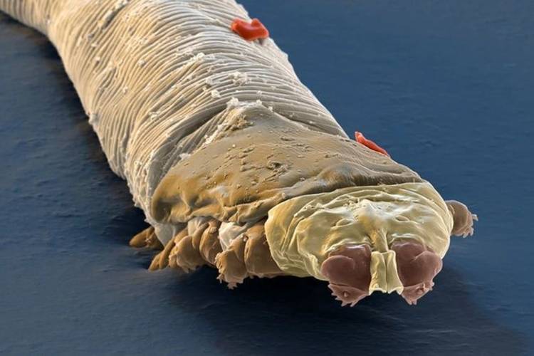 Ngga Sadar Tenyata 10 Hewan Ini Diam-Diam Hidup di Tubuh Manusia Berikut Hindari Ini agar Kamu Tidak Sering Digigit Nyamuk