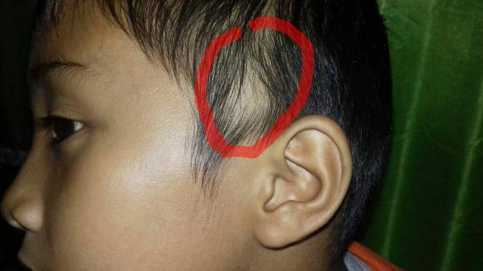 Lupa Bawa Buku Pelajaran, Rambut Ditarik hingga Tercabut